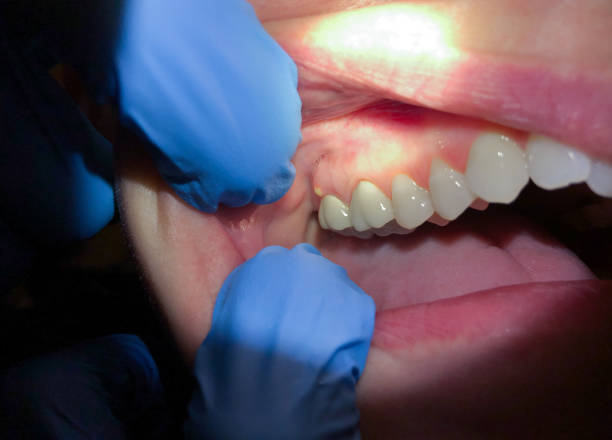 Best Pediatric Emergency Dentist in Taylorsville, KY
